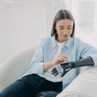 ProstheticArm